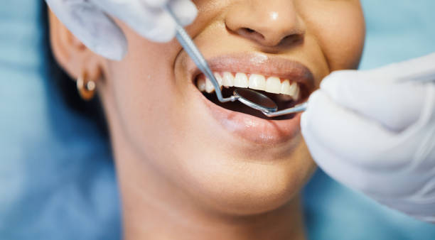 Best Emergency Dental Care for Broken or Chipped Teeth in Mckees Rocks, PA